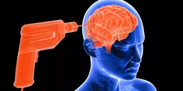 8 Practici Medicale Vechi Ce Au făcut Mai Mult Rău Decât Bine - Contemporary-Establishment